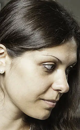 transformation-img-4